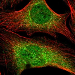 ZNF569 Antibody, Novus Biologicals 25 &mu;L, Unlabeled:Antibodies, Polyclonal